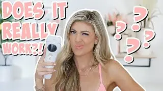 I TRIED LASER HAIR REMOVAL AT HOME! DID IT WORK?! 🤔 | @MadisonMillers