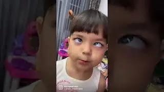 Mata jereng✅ Mata Biru❌