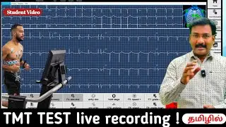 TMT TEST LIVE VIDEO  / EXPLAINED IN TAMIL   முழுமையான தகவல்  💯🎖✨️