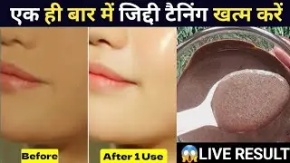 🌞Tanning Removal Homeremedy✨Suntan Remedy At Home🌼Tan Ko Kaise Dur Kare🌿 Tanning Removal Face Pack💛