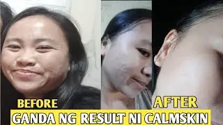 skin care routine by calmskin