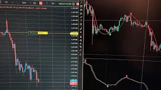 XAUUSD Live profit | XAUUSD strategy | live trading | forex trading strategy #trading #forex #xauusd