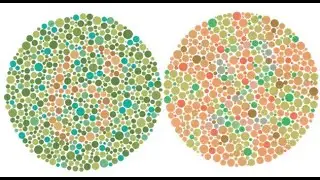 PHYSIOLOGY OF HUMAN EYE/VISION PART II (COLOUR VISION & REFRACTIVE ERRORS,ERG) DR ANAND BADWE