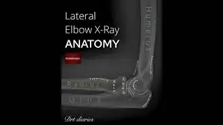 Ap and lateral view of elbow joint with anatomy #drt #paramedicaleducation #radiographer_course