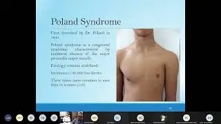 Chest Wall Deformities / Health of Science University