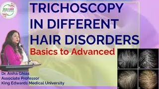 Trichoscopy in Different Hair Disorders l Basics to Advanced l Trichoscopy Complete Guide #haircare