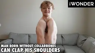 I Was Born Without Collarbones