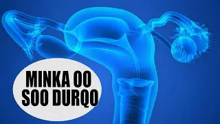 MINKA OO SOO DHACO AMA SOO DURQO {UTERINE PROLAPSE}                          Dr Fahad Al Al.Attas.