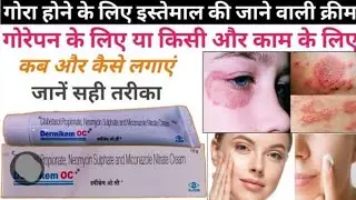 Dermikem oc Cream (alkem) ke fayde and side effects and right use in hindi full details