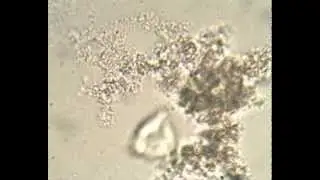 Bacterial cells agregate in flocs