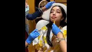 What It&rsquo;s Really Like to Get Lip Filler &ndash; Real Bride Experience