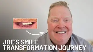 From Gum Disease and Missing Teeth to a Perfect Smile | Joe's Dental Implant Journey