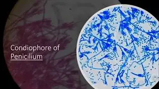 Study of Fungi (Permanent slides and Morphological studies of fruit bodies)