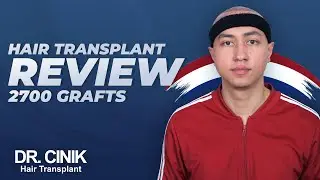 Hair Transplant Review - 2700 Grafts | Hair Transplant | Dr. Emrah Cinik