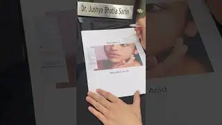 Target Your Skin Concerns the RIGHT Way | Dermatologist Approved || Dr. Sarin ||