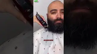 From Bald to Bold🔥