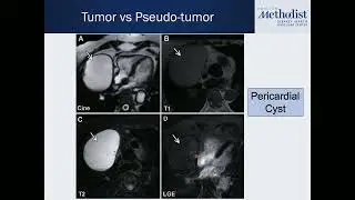 4.18.2023 MULTIMODALITY CONFERENCE: Karla M. Kurrelmeyer, MD, FACC, FASE & Carlos El-Tallawi, MD ...