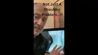 36-Year-Old with Chronic Shoulder & Arm Pain &mdash; Real X-Ray Breakdown & At-Home Rehab Tips