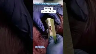 Asmr satisfying relaxation 😌 #asmrscalpscratching #scalptreatment #dandruffscratching @ivybasmr