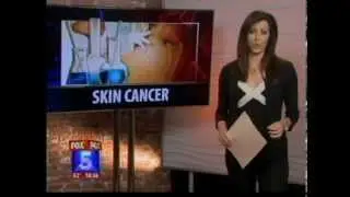 Congressman Brian Bilbray and Briana at press conference introducing Melanoma Research Act (FOX 5)