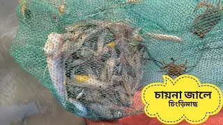 এমন চিংড়ি আগে দেখেননি! 😲 | China Net Prawn Fishing in River