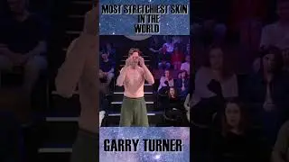 Garry Turner | stretchiest skin in the world #shorts #trending