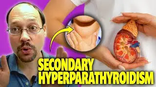 Slow Down Kidney Disease PTH (Parathyroid Hormone) and Kidney Disease Get Checked! *INSANE RESEARCH*