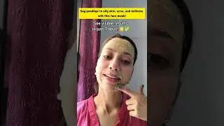 Remove acne in just seven days 🌿#acnefreeskin #oilcontrol #oilyskinsolutions #shorts #ytshorts #diy