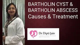 BARTHOLIN CYST & ABSCESS - CAUSES AND TREATMENT