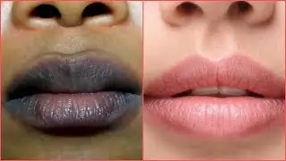 COMO ACLARAR LOS LABIOS OSCUROS. REMEDIO CASERO MUY EFECTIVO.