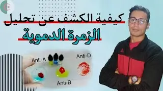 كيفية الكشف عن تحليل الزمرة الدموية | Comment réaliser un groupage sanguin (ABO)