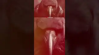 &iexcl;Los cuervos buscan venganza! #datoscuriosos #cuervo #aves #terror #peligro #miedo #fobias