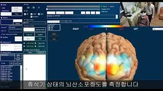 2.  NIRSIT 가동 및 휴식상태 측정