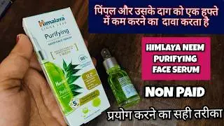 Himalaya Neem Face Wash के साथ लगाए Himalaya Neem Face Serum | 2026 | फायदे और नुकसान
