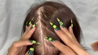 Extreme Scalp Cleaning ASMR | Dandruff Removal with Tweezers, Comb & Long Nails IMG 6089
