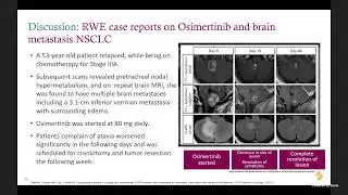 Lung Cancer Treatment Updates 2024 - 29 May