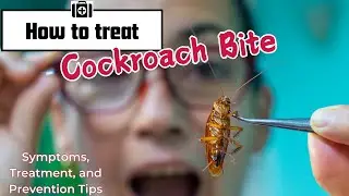 Cockroach Bites: Symptoms, Treatment, and Prevention Tips