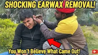 Ultimate Ear CLEANING AND REMOVAL PROCESS WITH DEEP OILLING AND TINGLING|EAR CLEANING ASMR|ASMR MAYA