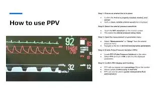 Pulse Pressure Variation DSP Project