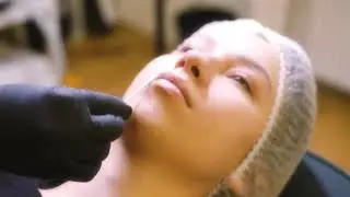 Hyaluron Pen Training Mua Academy
