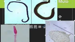 Schistosoma mansoni