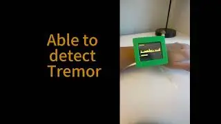 Real-Time Parkinson&rsquo;s Symptom Detection via Embedded FFT | ECE 4144 Project