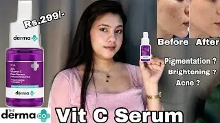DERMA CO 10% Vit C Serum. Review !! Remove Pigmentation, Dark spot. Honest Review!!