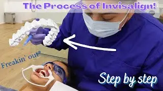 The Process of Invisalign!!!