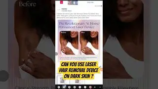 Can You Use Laser Hair Removal on Dark Skin? The Real Answer Explained #darkskincare