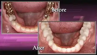 A Gold-Standard Expert in Full-Mouth Reconstruction, Dr. Anthony Mobasser - Celebrity Dentist