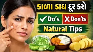 ચહેરા પરથી કાળા ડાઘ કેવી રીતે દૂર કરશો? | Dark Spots Removal Tips | Do’s & Don’ts in Gujarati