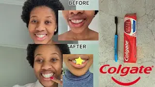 I Tried The Colgate Optic White Toothpaste For Two Weeks & Results Shocked Me