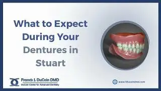What to Expect During Your Dentures in Stuart