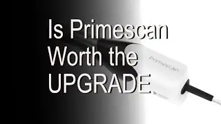 Is Primescan worth the upgrade?